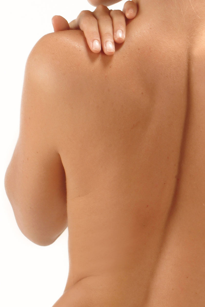 Titan Skin Tightening Villa Park