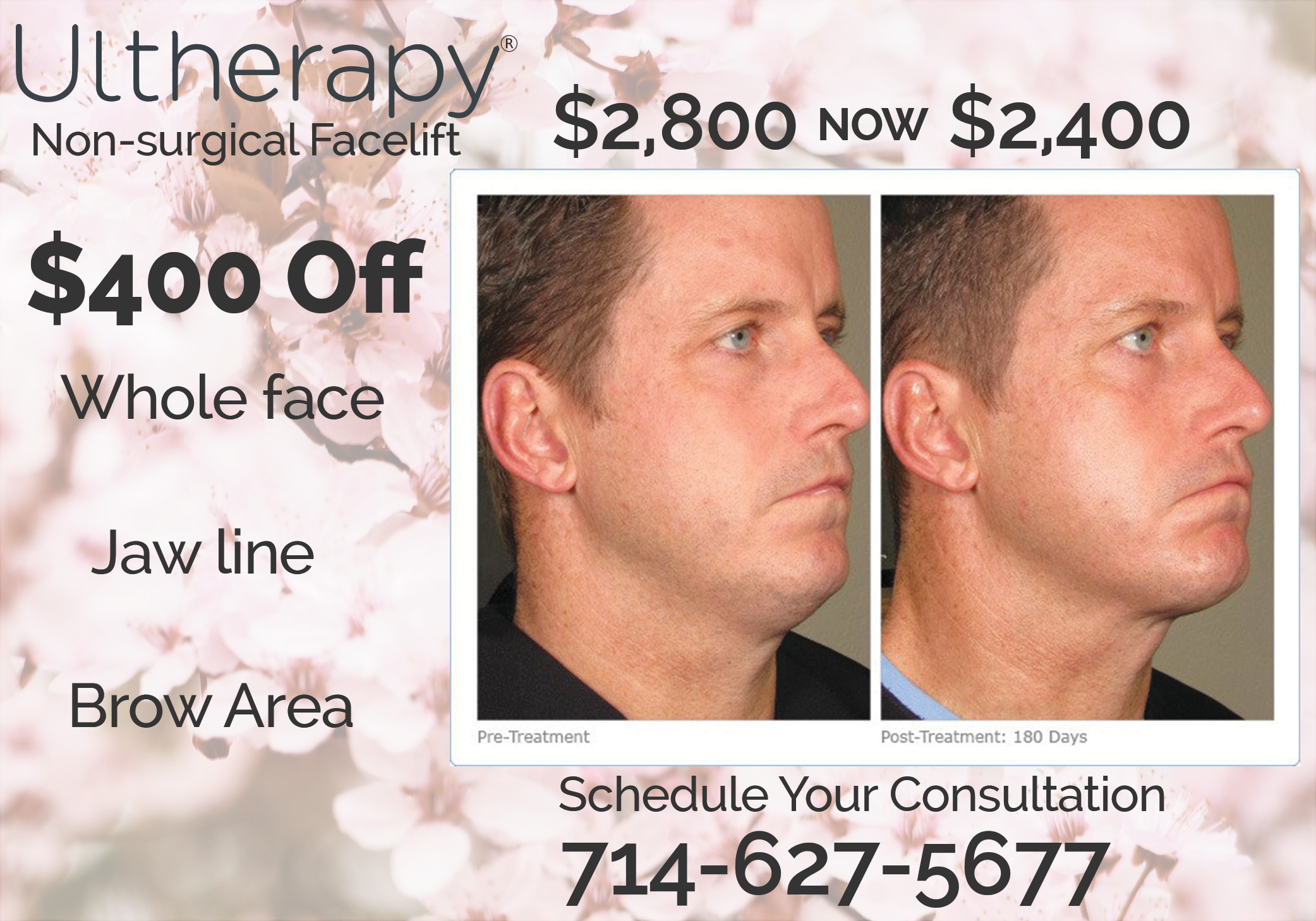 Clinical Aesthetics Ultherapy